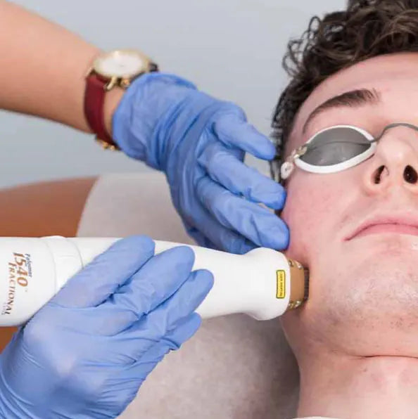 Man receiving an Icon 1540 fractional laser treatment