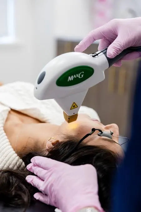 IPL photofacial on the side of the face