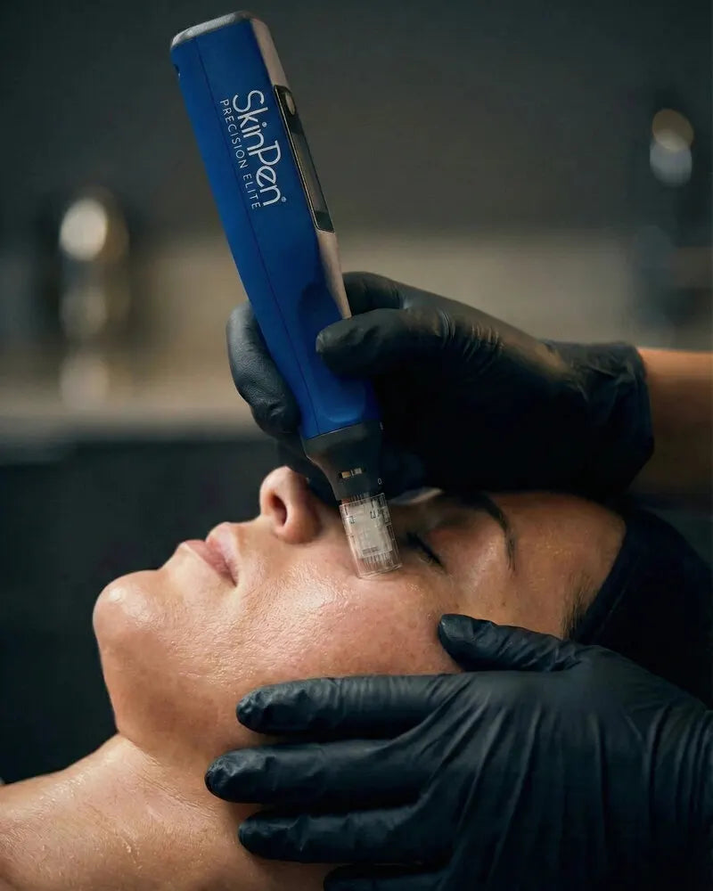 Man receiving SkinPen microneedling in Bradenton