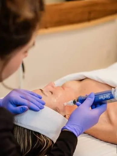 SkinPen microneedling treatment at a Bradenton med spa