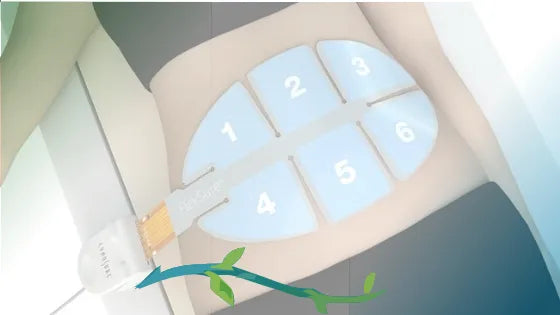 Flexsure Body Booster