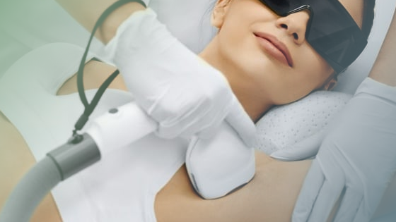 Laser Hair Removal in Bradenton