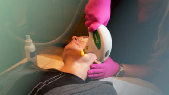 Why IPL Treatments Are So Popular in Bradenton