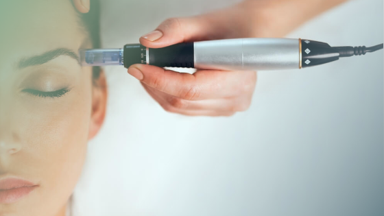 Finding the Right Microneedling Studio in Bradenton