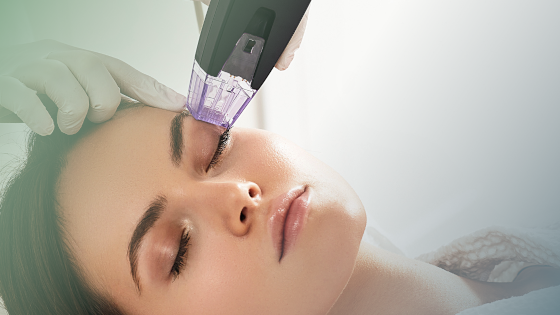 Top Reasons to Use Morpheus8 in Bradenton