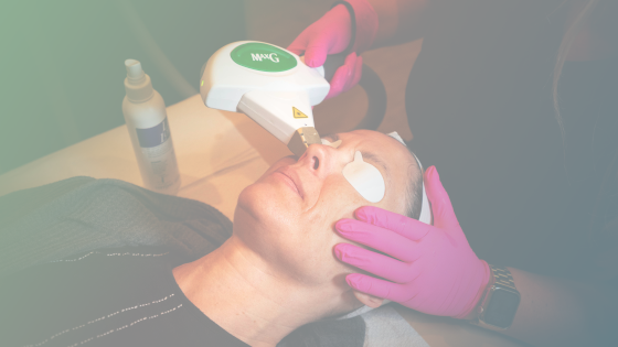 What Is IPL Laser Light Treatment?