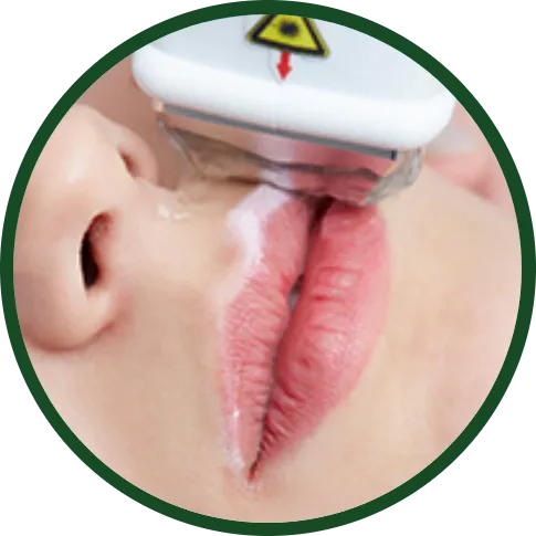 <p>A laser treatment designed to address three common skin concerns—wrinkles, sun damage, and facial veins—in a single session.</p>
