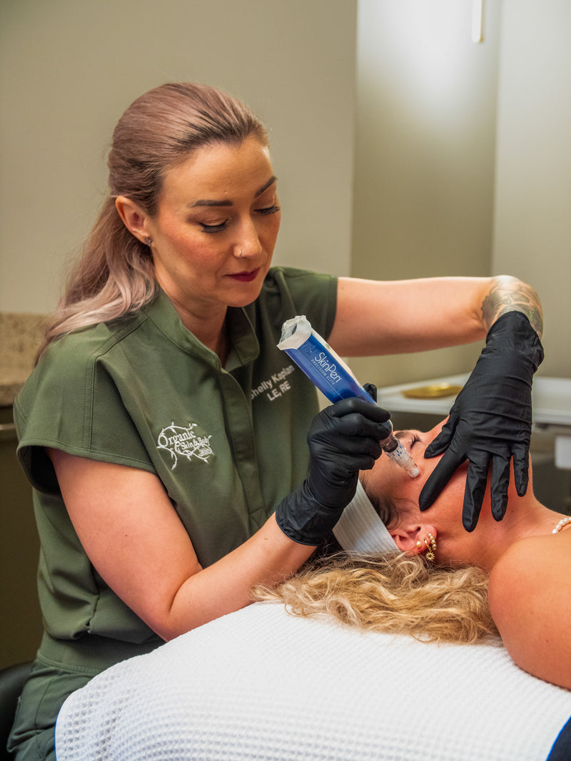 SkinPen Elite microneedling at Organic Skin and Body Medical Aesthetics in Bradenton, FL
