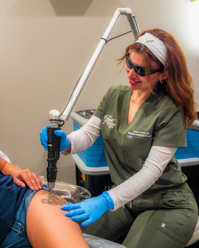 PicoSure tattoo removal at Organic Skin and Body Medical Aesthetics in Bradenton, FL