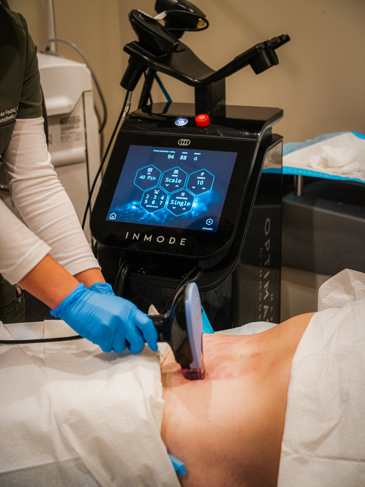 Morpheus8 at Organic Skin and Body Medical Aesthetics in Bradenton