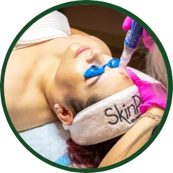 <p>This FDA-cleared procedure helps improve fine lines, acne scars, and overall skin texture with minimal downtime. It promotes natural skin regeneration, making the skin smoother, firmer, and more youthful over time.</p>