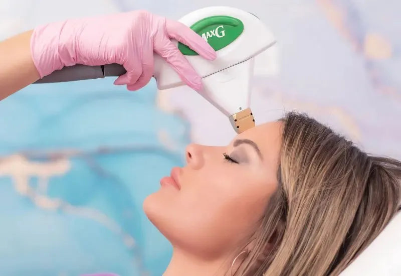 IPL handpiece on the forehead during a photofacial