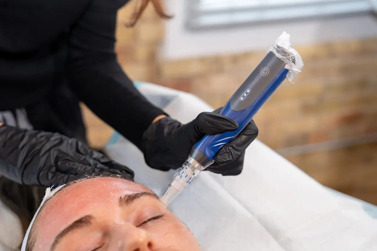 SkinPen Elite microneedling on the face in Bradenton, FL