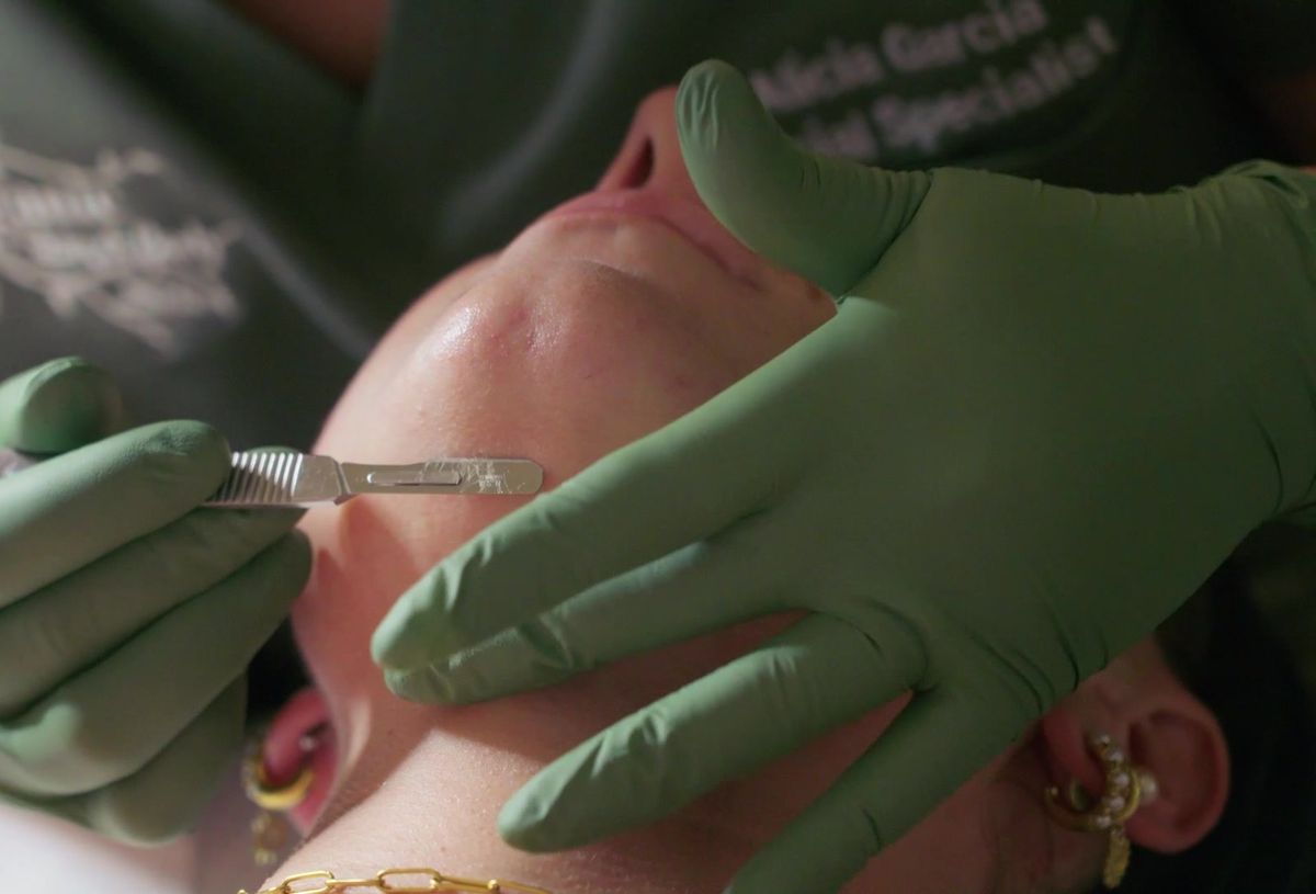 Dermaplaning treatment by an Organic Skin and Body facial specialist in Bradenton