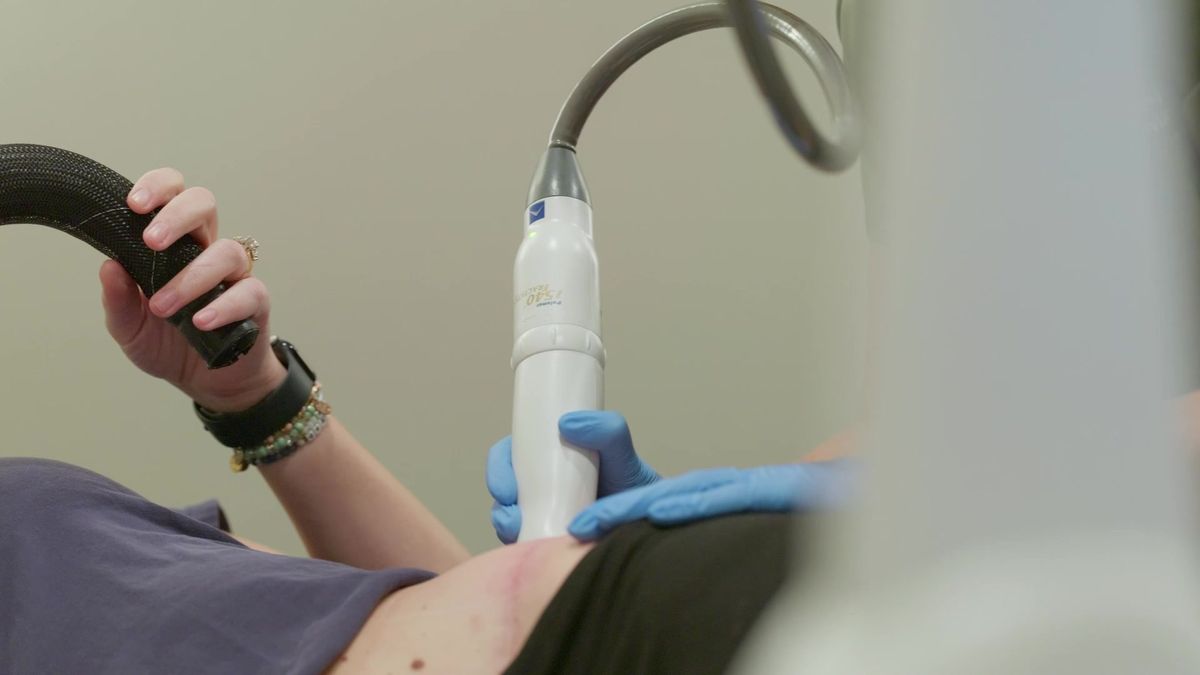 Fractional laser handpiece during a resurfacing session in a Bradenton treatment room